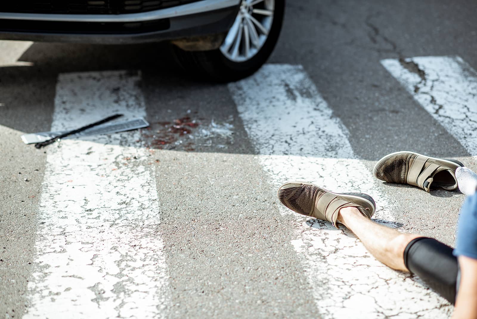 Injured pedestrian after being struck in a crosswalk