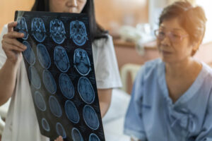 Experience Lawyer for Brain Injury Cases near Las Vegas, NV area