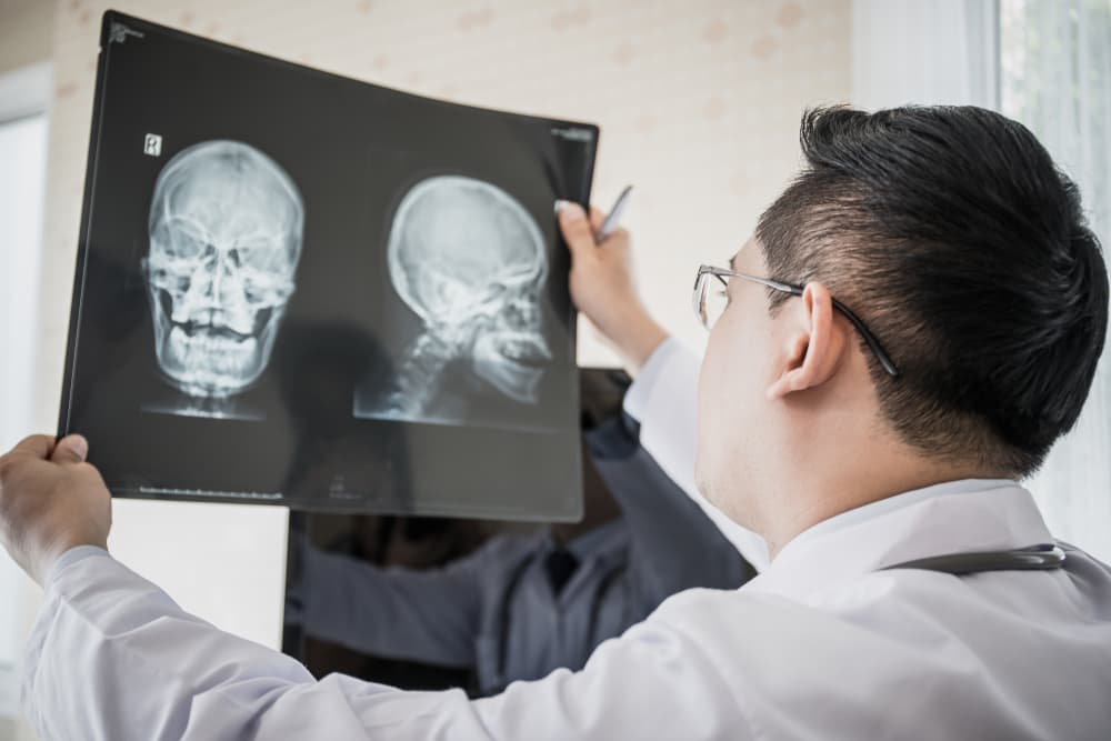 Skull Fracture I Head Injury in Bicycle Accident